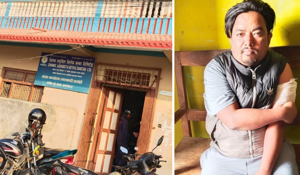 लुटेराले चक्कु प्रहार गर्दा छिमेक लघुवित्तका कर्मचारी घाइते